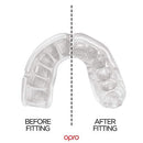 Power-Fit Mouthguard for All Contact Sports - MYRINGOS